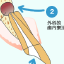 歯根端切除術