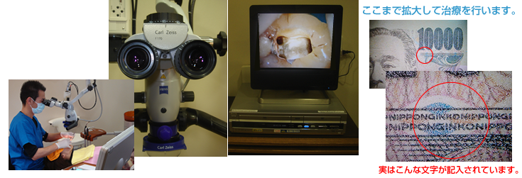 歯内療法　手術用顕微鏡資料 + 説明用モニター