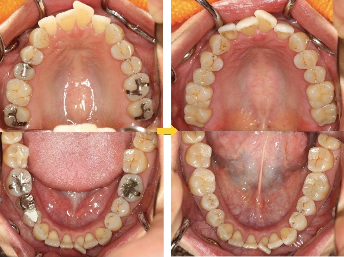 CASE9.全顎治療