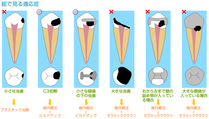 絵で見る適応症