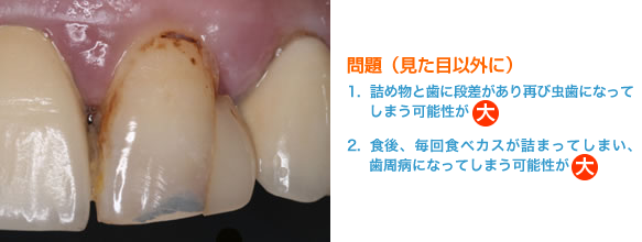 従来型のプラスチック修復