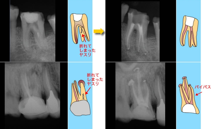 case15.jpg